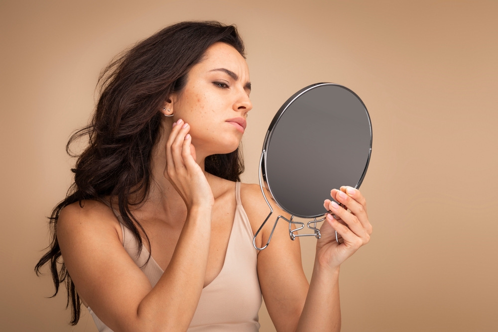 femme avec taches visage